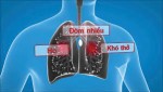 tải xuống   2026 03 27T162755 412